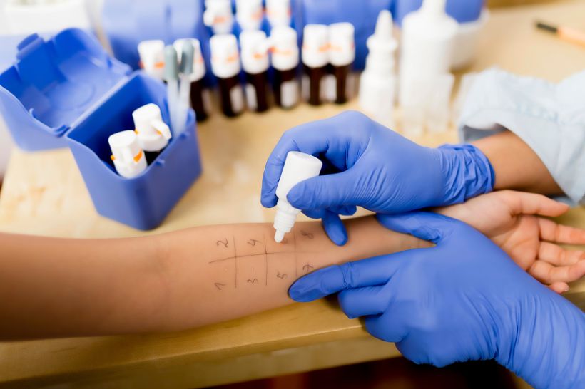 Allergiker sollten beim Arzt einen Pricktest zur Allergiebestimmung durchführen lassen
